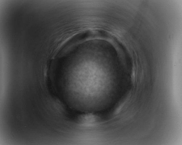 X0000089450219200706151437