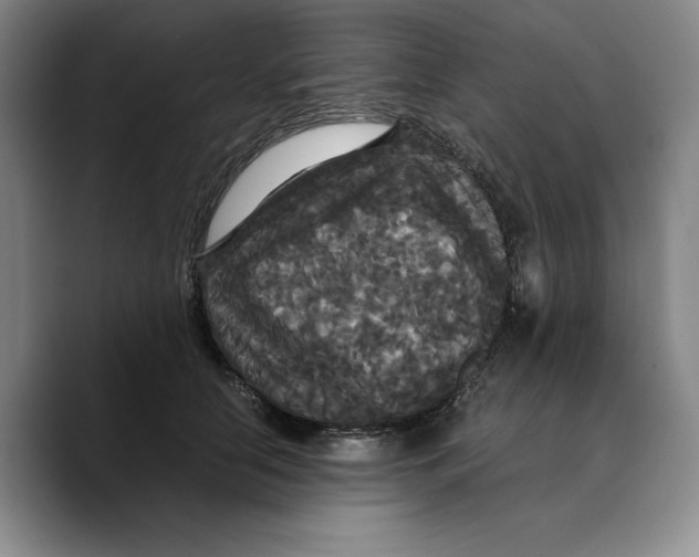X0000089670658200707201640