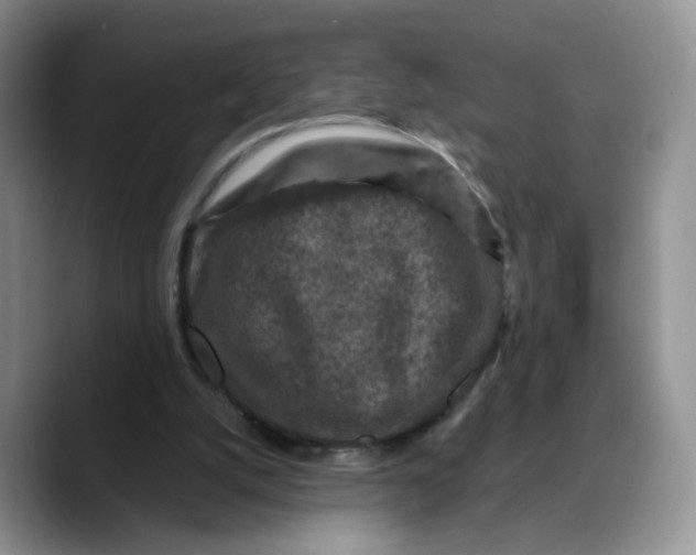 X0000089680056200707201708