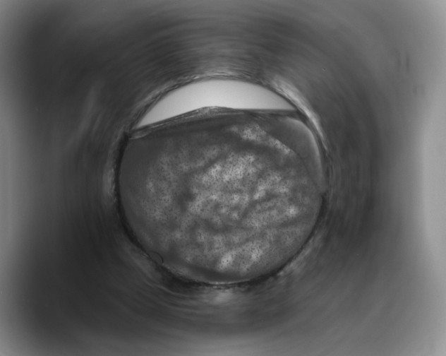 X0000089680249200707201705