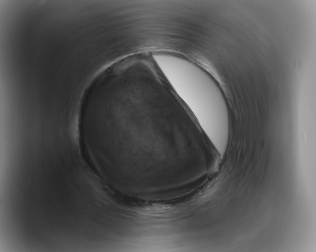 X0000089680387200707201704