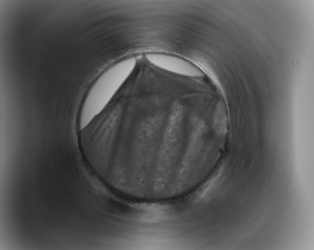 X0000089680389200707201704