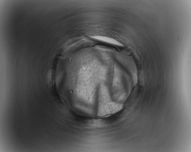 X0000089680428200707201704
