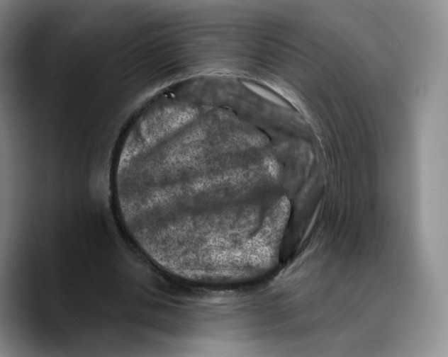 X0000089680438200707201703