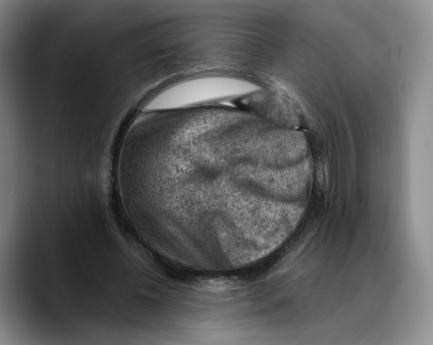 X0000089680540200707201702