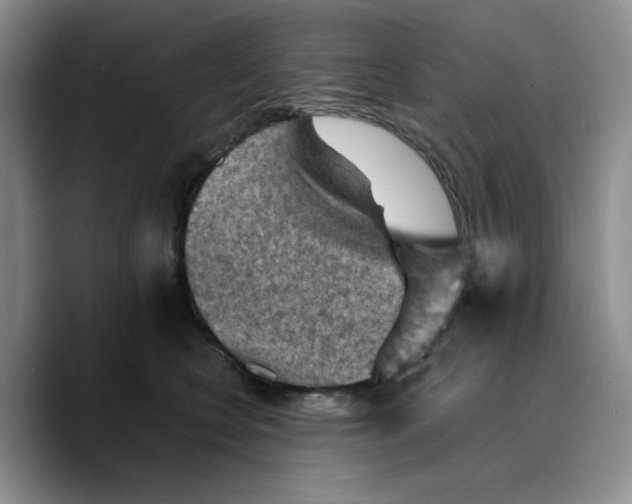 X0000089680566200707201702