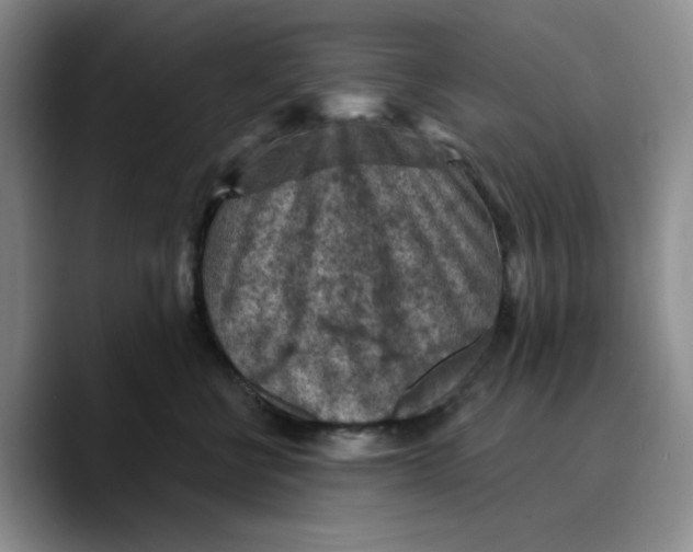 X0000089680570200707201702