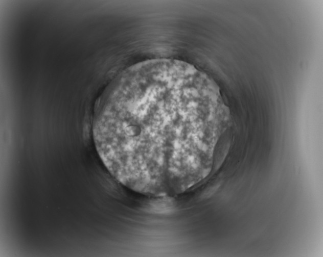 X0000089680576200707201702