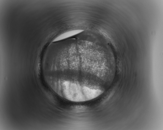 X0000089680590200707201701