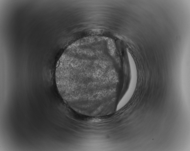 X0000089680759200707201700