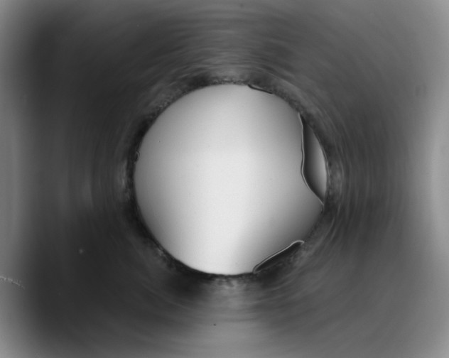 X0000089680764200707201700