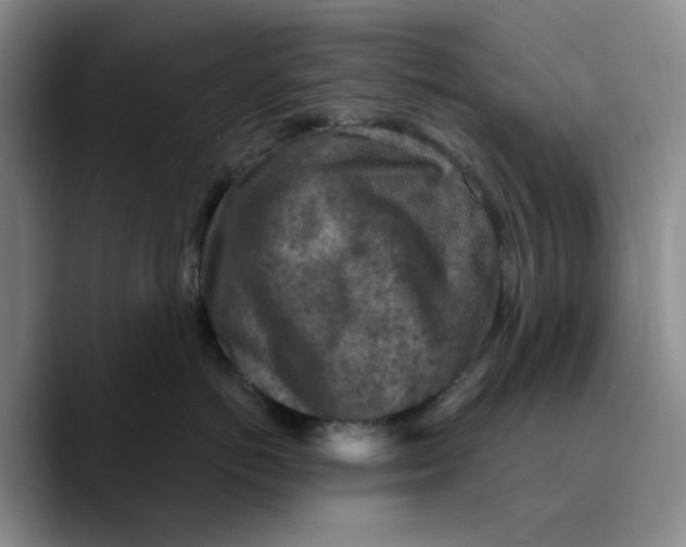 X0000089680766200707201700