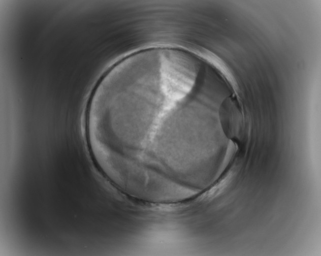X0000089680958200707201657