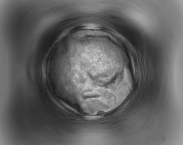 X0000089681487200707201649