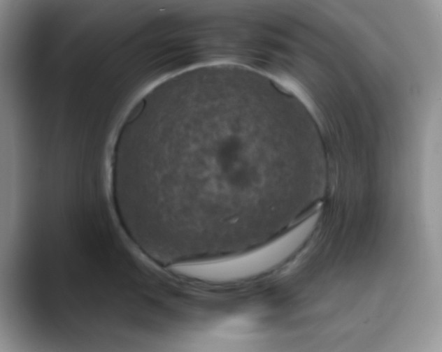 X0000089691151200707051620