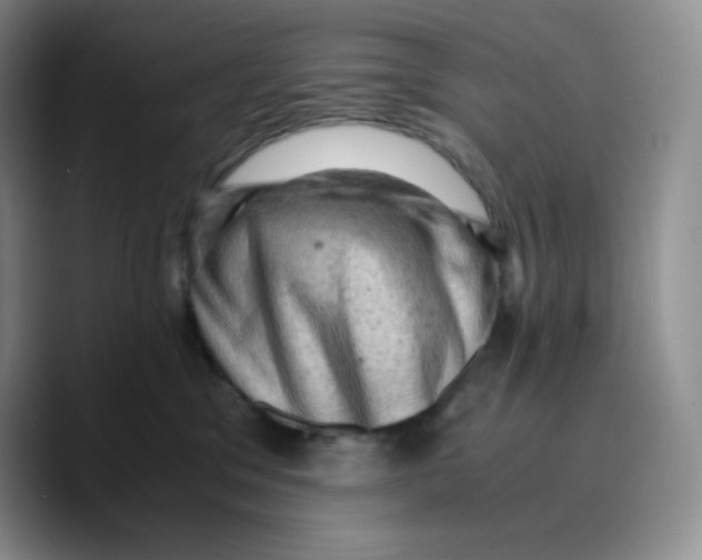 X0000089690329200707201725