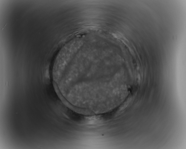X0000089690516200707201723