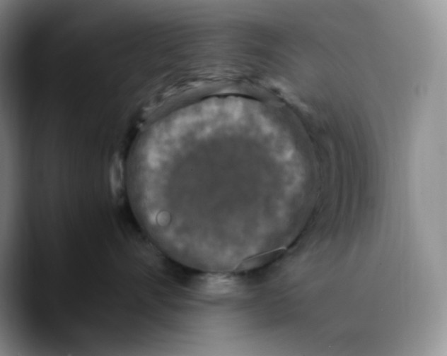 X0000089690528200707201722