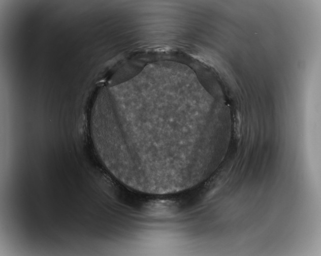 X0000089690748200707201720