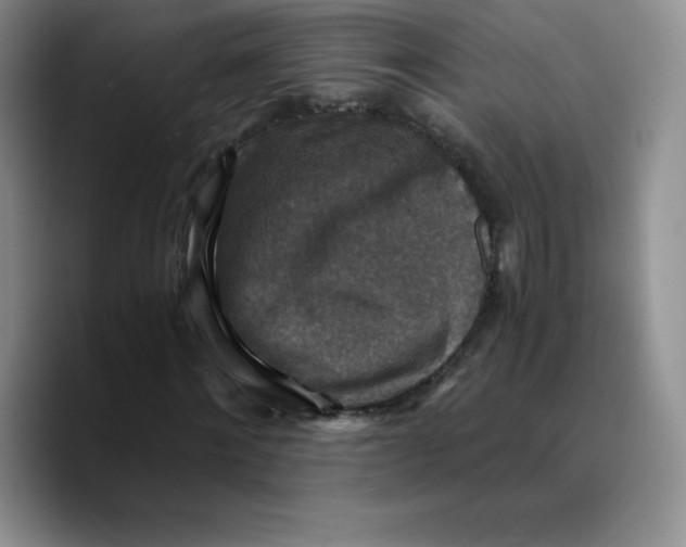 X0000089690868200707201718