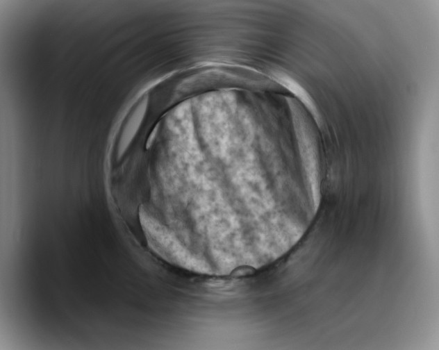X0000089691146200707201715