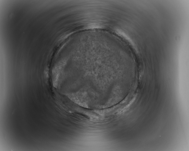 X0000089691169200707201714