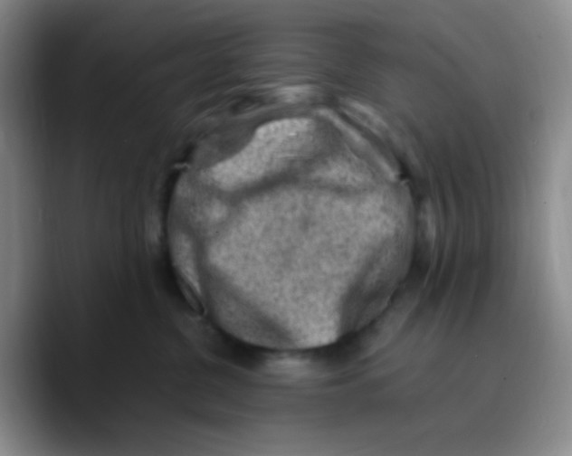 X0000089710380200707201805