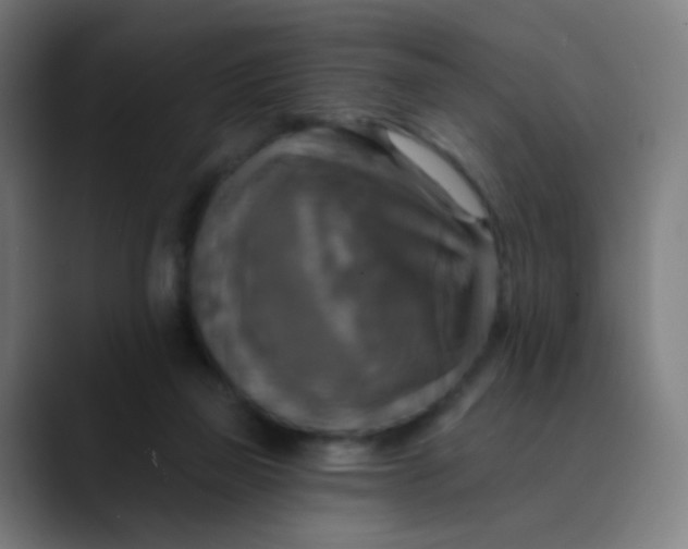 X0000089720165200707121437