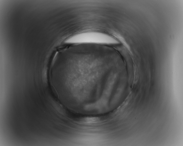X0000089730154200707201848