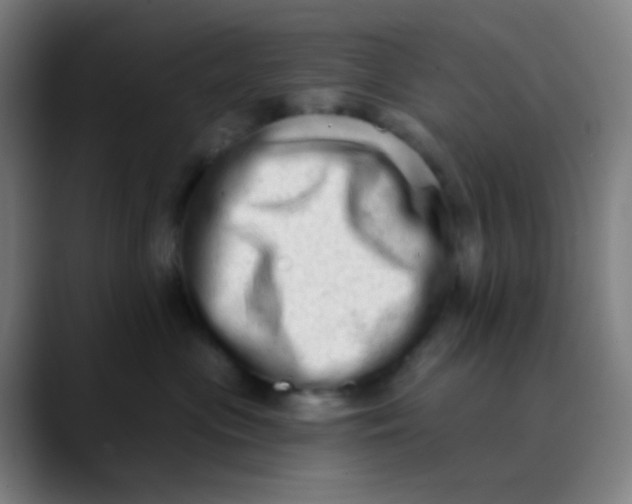 X0000089740477200707121510