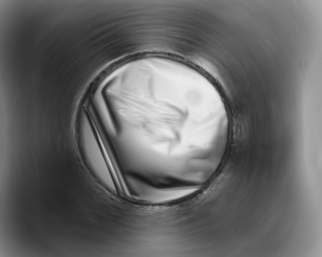 X0000089741068200707201857
