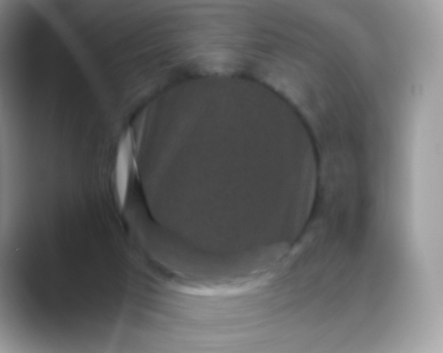 X0000089750017200707051823