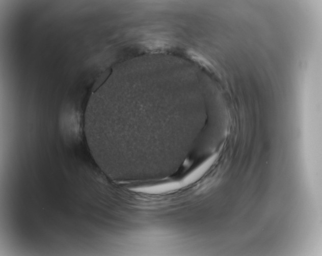 X0000089751156200707051810