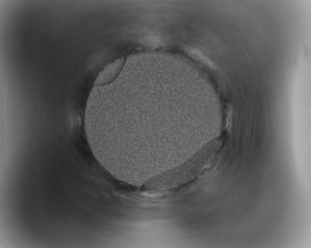 X0000089751302200707201914