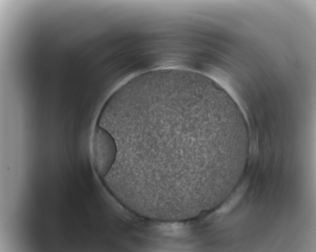 X0000089830957200707051036