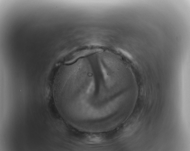 X0000089851303200707051107