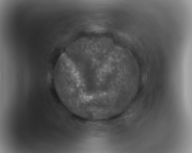 X0000089881397200707191948