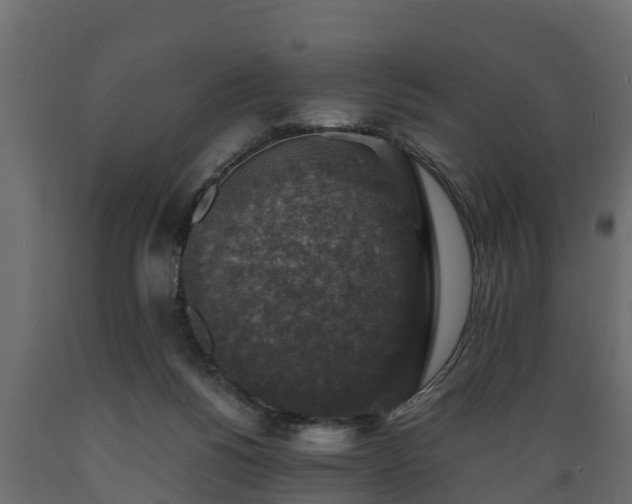 X0000089920168200707061026