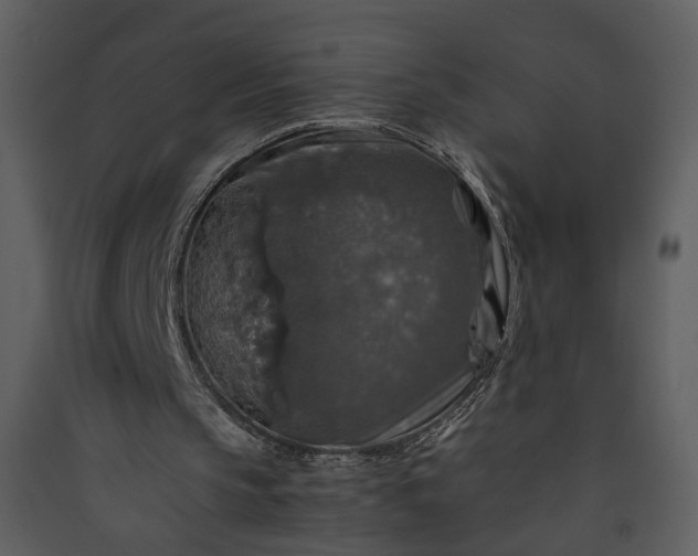 X0000089920145200707131418