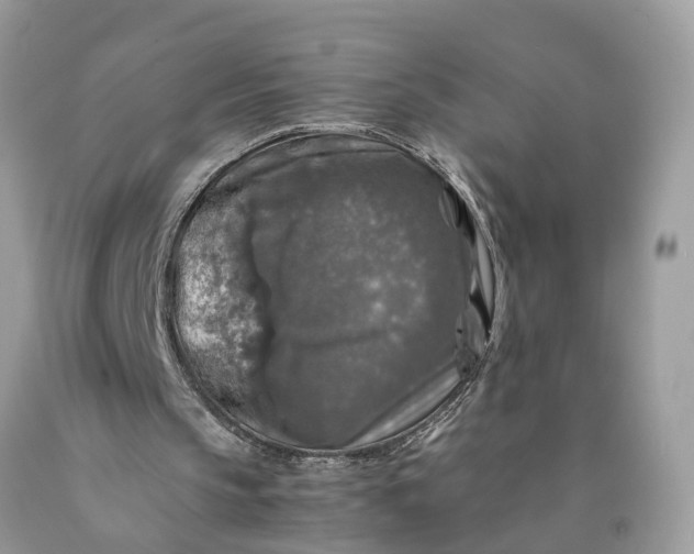 X0000089920145200707201825