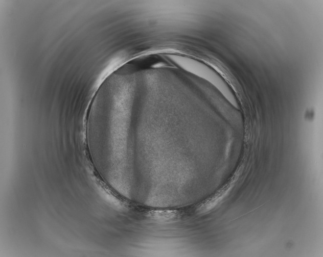 X0000089920858200707201817