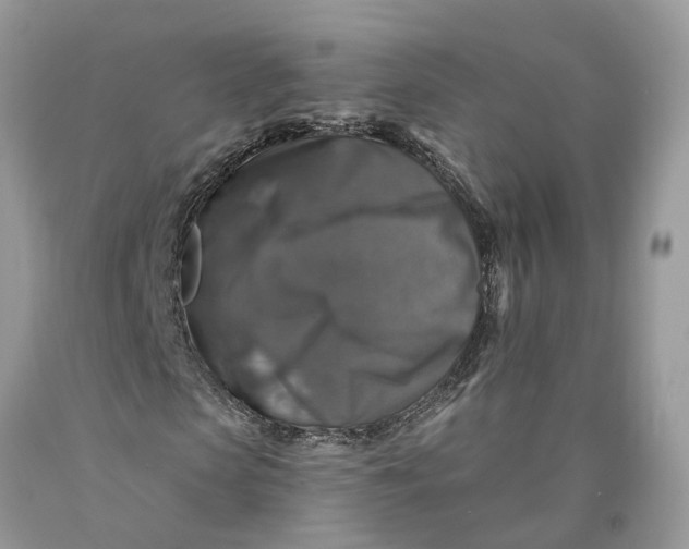 X0000089920913200707201815