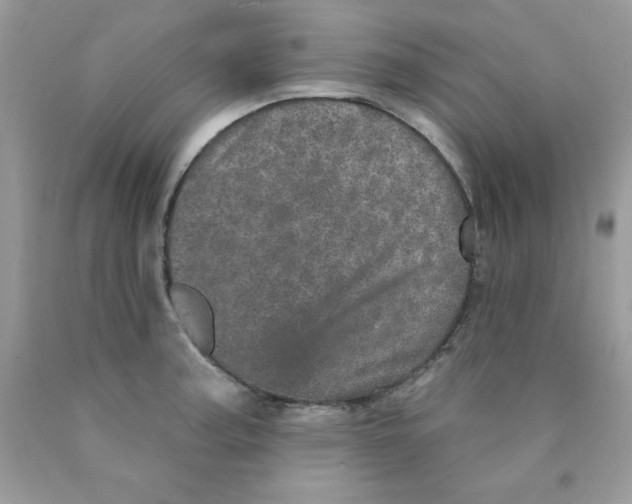 X0000089941187200707201856