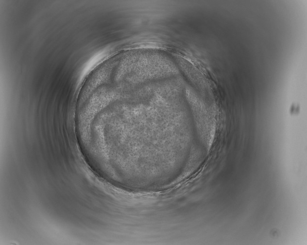 X0000089940004200707271828