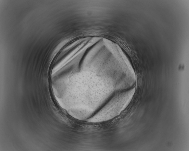 X0000090420147200708031114