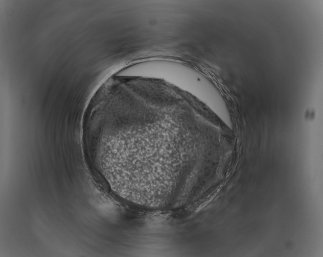 X0000090420148200708031114