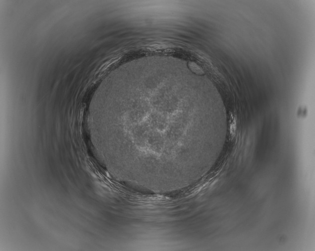 X0000090440819200707201251