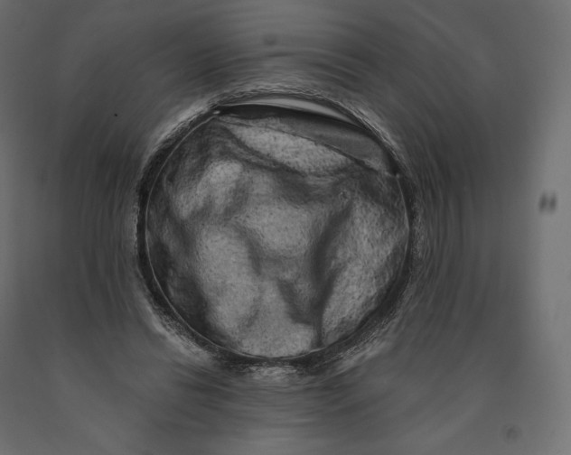 X0000090440446200708031158