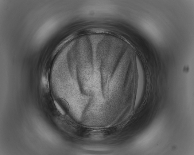 X0000090441198200708031146