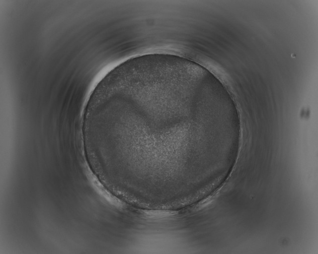 X0000090441200200708031146